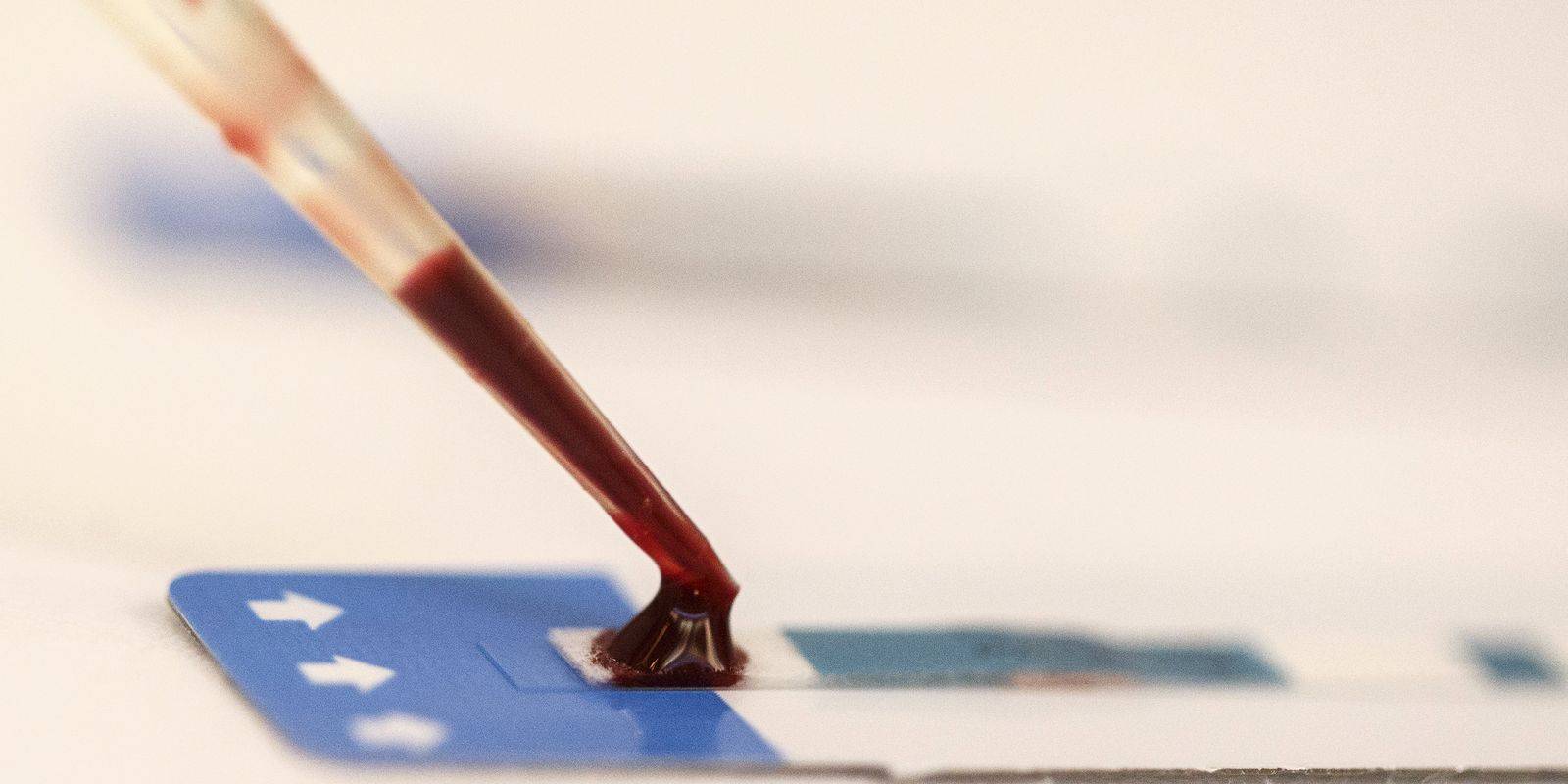unicef:-maioria-de-jovens-com-hiv-aprova-acolhida-em-servicos-de-saude