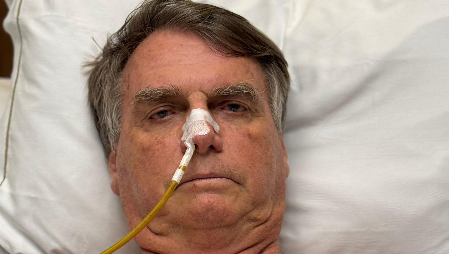 Estável, Bolsonaro deixa UTI, mas segue sem previsão de alta hospitalar