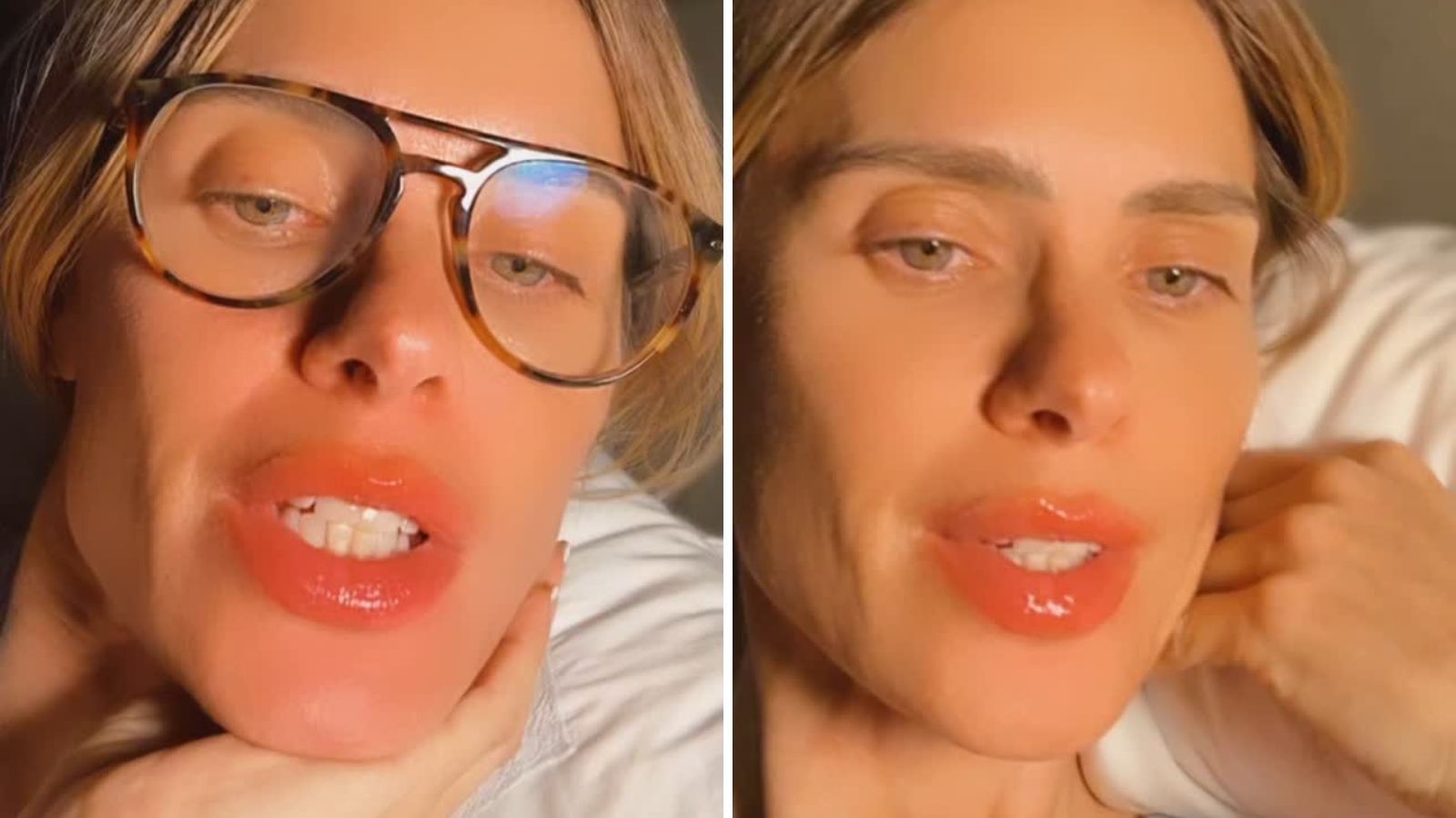 Carolina Dieckmann relata reação alérgica nos lábios após voo