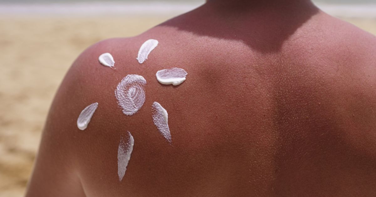 Skincare de verão: veja o que deve ser evitado ao cuidar da pele