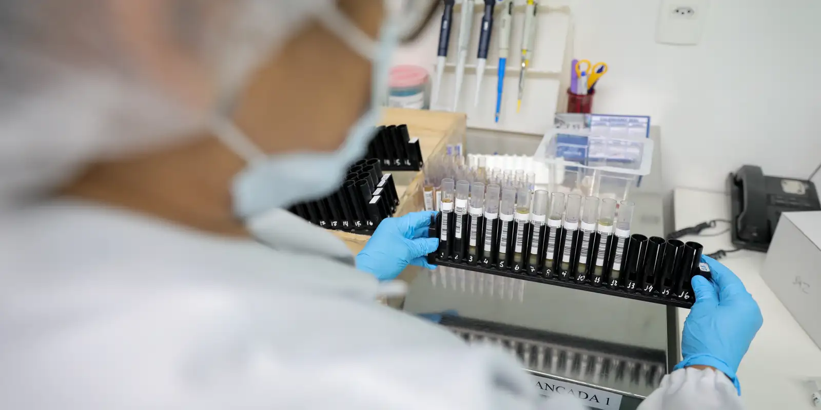 Malária: Anvisa autoriza teste em humanos de vacina 100% brasileira